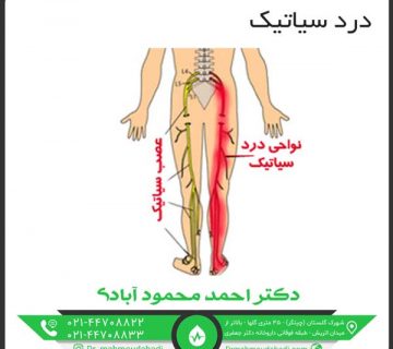 درد سیاتیک کلینیک طب فیزیکی و توانبخشی دکتر احمد محمود آبادی