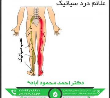 علائم درد سیاتیک کلینیک طب فیزیکی و توانبخشی دکتر احمد محمود آبادی