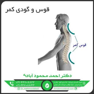 قوس و گودی کمر کلینیک طب فیزیکی و توانبخشی دکتر احمد محمود آبادی